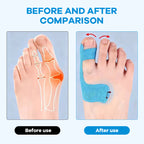 🩹Pre-Cut Bunion Kinesiology Tape for Bunion Relief | Portable, Stretchable Tape for Daily Wear, Sports & Long Walking