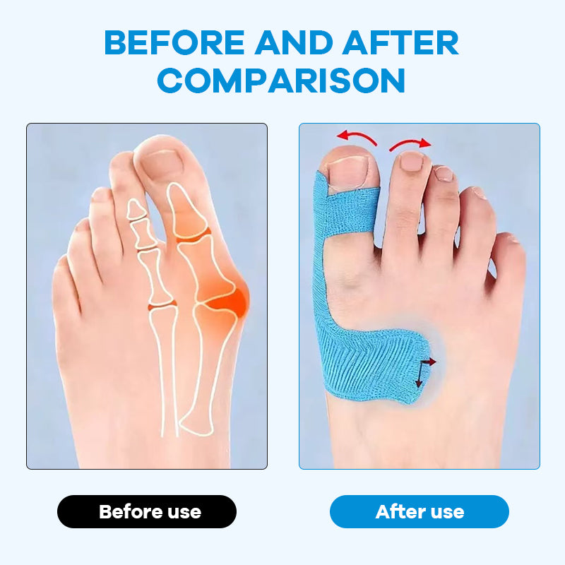 🩹Pre-Cut Bunion Kinesiology Tape for Bunion Relief | Portable, Stretchable Tape for Daily Wear, Sports & Long Walking